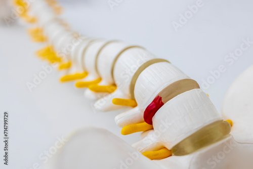 Total human spine skeleton model with isolated on white background.Cervical, thoracic and lumbar spine to sacrum.Doctor in the orthopedic unit uses it for patient education before surgery.