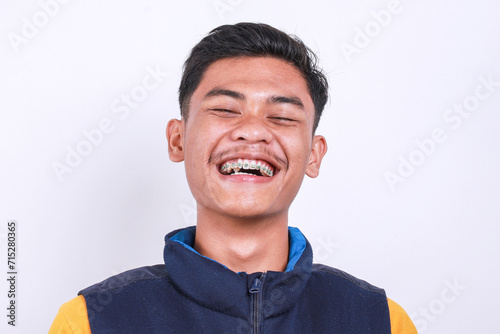 Portrait of cheerful young Asian man with dental braces laughing at camera