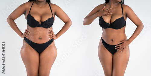 Tummy tuck, fat body before and after weight loss and liposuction on gray background, black African woman, plastic surgery concept