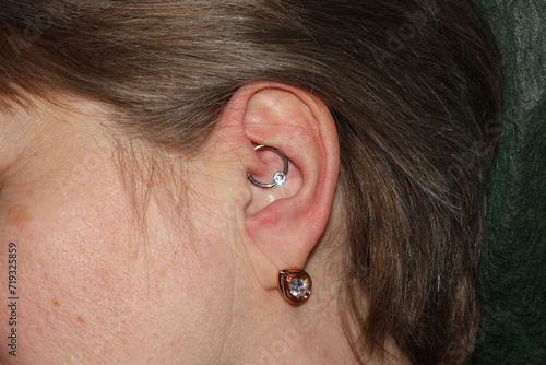 Ear cartilage piercing on a woman. Macro. Daith piercing + ball captive ring with cubic zirconia. 