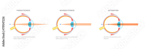 Farsightedness and nearsightedness