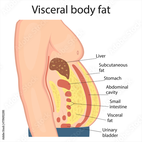 Visceral fat and subcutaneous fat accumulate around organs. Medicine and health diagram about belly fat.