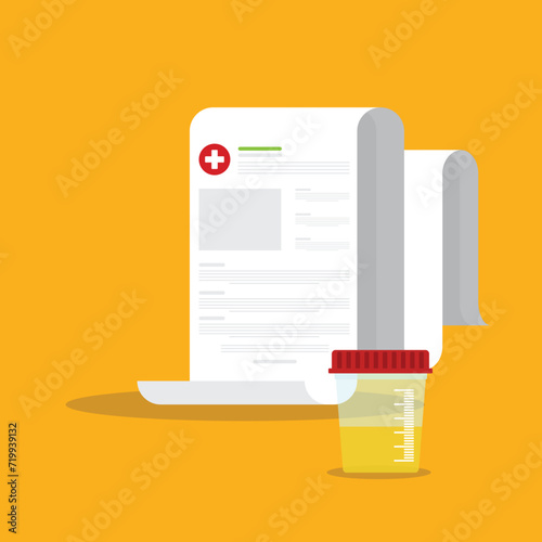 Urine test. Urine analysis. Pee sample in a plastic box and medical clipboard. 