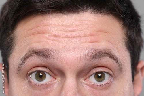 Closeup view of man with wrinkles on his forehead