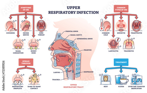 Upper respiratory infection with symptoms and types outline diagram, transparent background. Labeled educational health condition scheme with coughing, sore throat and nasal problems illustration.