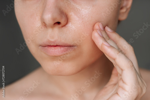 Cropped shot of a young caucasian woman with greasy skin touching the face with her hand isolated on a dark background. Cosmetology and beauty concept. Oily skin, shine on the face