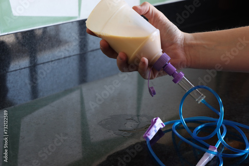 Woman holding the enteral nutrition bottle and infusion set in the kitchen. Enteral nutrition beeing prepared in the kitchen 