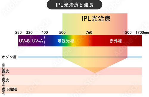 IPL光治療 アレキサンドライト レーザー 波長 図 パルス幅