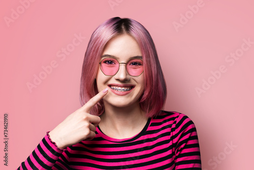 Dental dent care ad concept image - pink haired funny young woman girl in metal braces wear sunglasses eye glasses, stripes long sleeve shirt pointing white teeth smile. Isolated color wall background