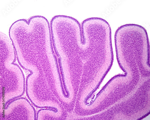 Immature cerebellum. External granular layer