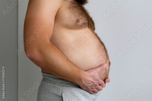 Man with bare fat big belly shakes fat folds on his stomach, obesity, health, beer belly. Problem area of body. Hormones. Overweight. Obesity. Copy space