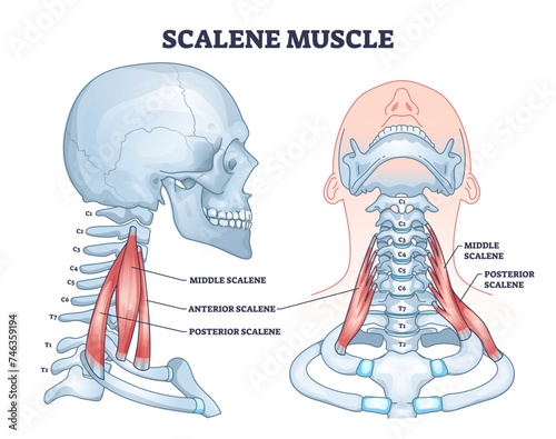 Scalene muscle structure with medical location on neck outline diagram, transparent background. Labeled educational anatomical sprain scheme with middle.