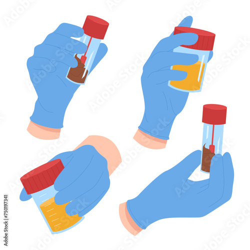 Laboratory analysis of urine and feces for medical clinical diagnosis. Doctors hands in blue latex gloves holding test tubes, containers with human excrements samples cartoon vector illustration
