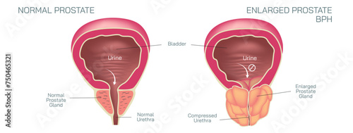 The prostate gland is located just below the bladder in men and surrounds the top portion of the tube that drains urine from the bladder or urethra vector illustration. Students study material.