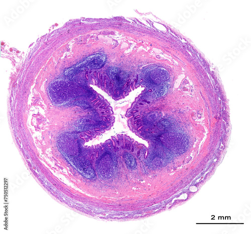 Human appendix