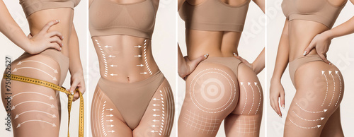 Banner. White lines on slim female body against white background, Anticellulite, lifting plan. Body positivity. Concept of beauty procedures, cosmetology treatment, massage. Ad