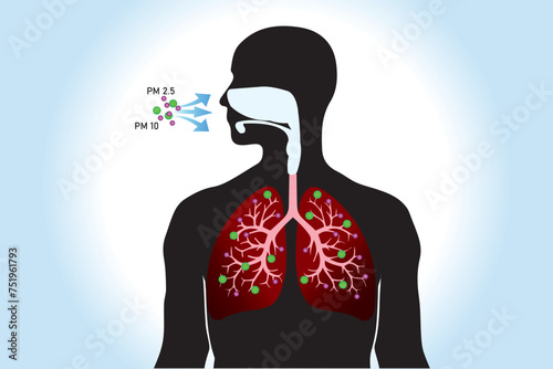 Breathing unhealthy levels of pollution from fine particulates (PM2.5) can increase the risk of health problems like heart disease, asthma, and low birth weight.