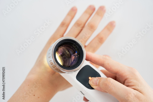 Overhead image of hands are using a dermatoscope to examine nevi (moles) on the surface of a hand against a white background showing the importance of skin examinations for early detection of melanoma