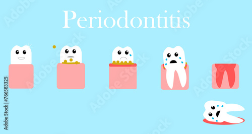 Periodontitis vector illustration. From a healthy tooth to its loss