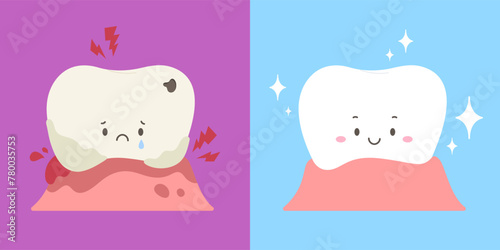 Weak tooth with lesions compare with strong tooth. Illustration of tooth decay, plaque, gum pain or gingivitis and healthy tooth. Concept of dental health, dentistry. Flat vector illustration cartoon.