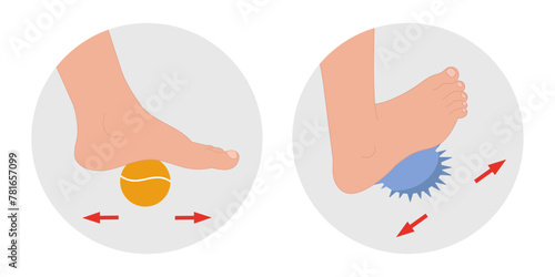 Special exercise for food deformation problem. Orthopedist Therapeutic and strengthening foot with tennis ball and fitness massage ball 