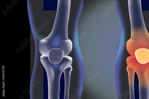 human leg anatomy with bone