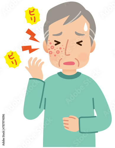 帯状疱疹ができて痛みがある高齢者男性 症状