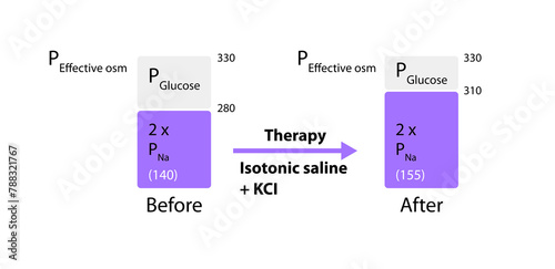 Plasma's effective osmolality defense ensures balanced hydration, vital for cellular function and overall physiological stability, 2d