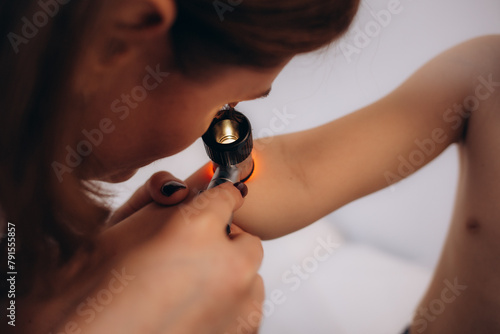 Close-up Of Doctor Examining Skin Of Child Patient With Dermatoscope