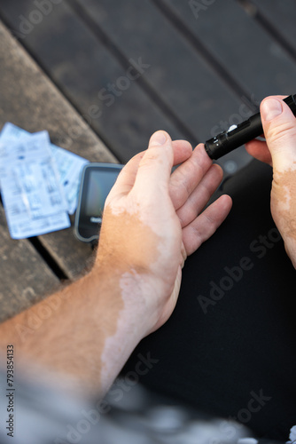 Men check their sugar levels using a lancet pen and glucometer