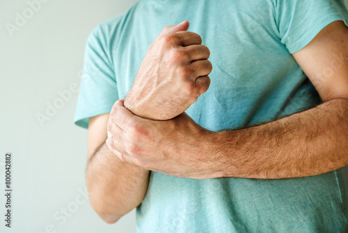 Severe rheumatic wrist pain symptoms, man with painful medical condition