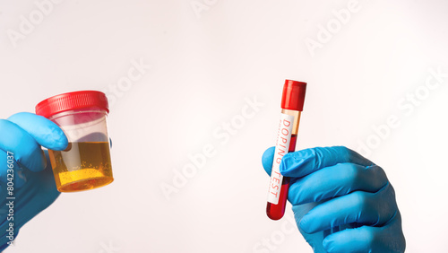 Doping Test of Olympic Games Athletes. Test tube with doping test of athlete's blood on white background. The concept of doping by athletes to prepare for the Olympic Games.