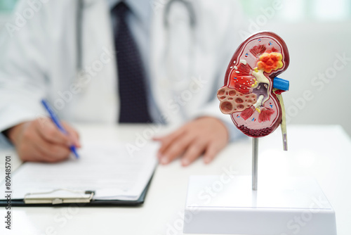 Chronic kidney disease, doctor with model for treatment urinary system, urology, Estimated glomerular filtration rate eGFR.