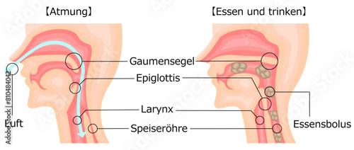 飲食 呼吸 嚥下性無呼吸 イラスト ドイツ語