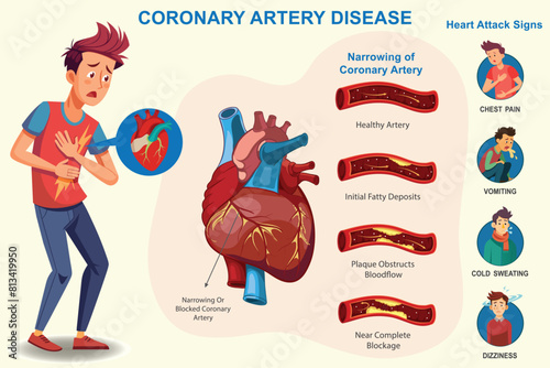Coronary artery disease which Narrowing of heart arteries, restricting blood flow, leading to heart attacks and chest pain, Which increases risk of heart attack. 