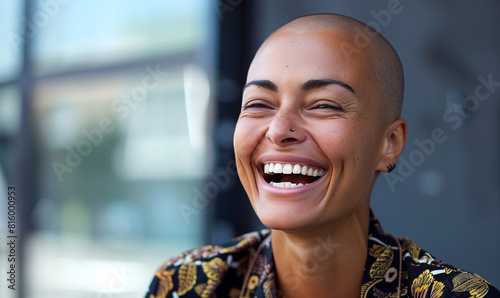 Happy candid bald woman laughing. Inclusive image of mixed race businesswoman with alopecia hair loss condition. Inclusion & diversity in workplace
