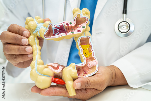 Intestine, appendix and digestive system, doctor holding anatomy model for study diagnosis and treatment in hospital.