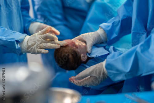 Professional anesthesiologist doctor medical team and assistant is performing baby cesarean section and hold the baby giving birth with surgery equipment in modern hospital operation room