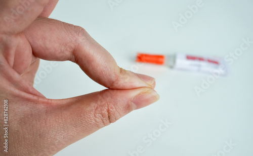 Human hand fingers glued together with strong adhesive super glue. Can not get super glue off the skin condition illustrative photography isolated on horizontal white background.