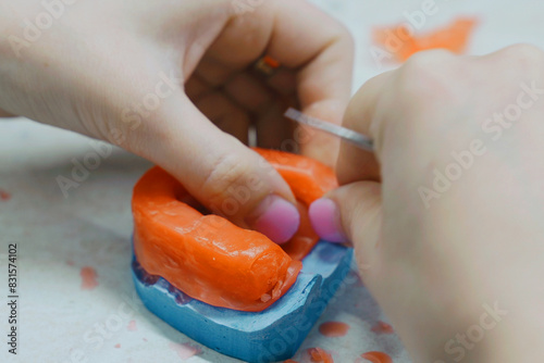 The dental technician makes a wax base and adds wax to form the mold.