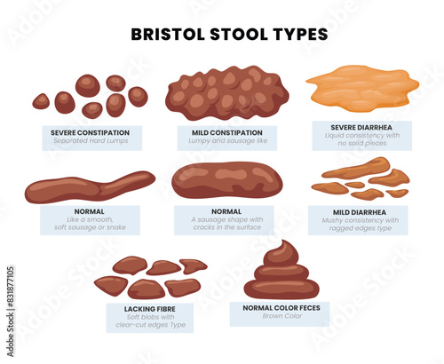 Set of various types human feces - constipation, normal and diarrhea. Bristol stool set with different types of poo, Excrement at health stomach and diseases of digestion. vector illustration.