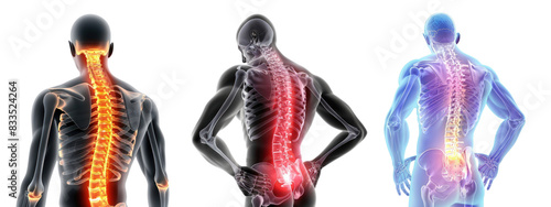 3D Chiropractic illustration of glow spine set