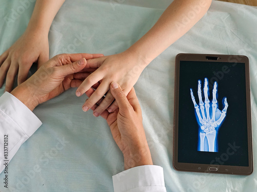 Doctors point to x-ray medical imaging with hand bone disease