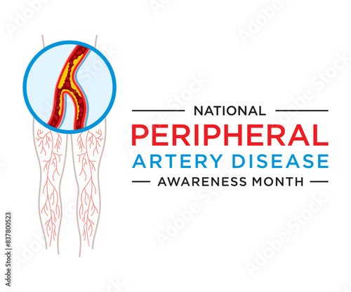 Peripheral Artery Disease (PAD) Awareness Month is an annual observance dedicated to raising awareness about peripheral artery disease.