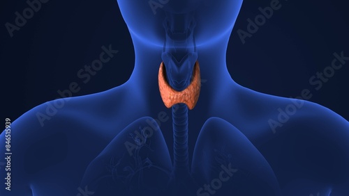 Medical animation of Thyroid gland cancer