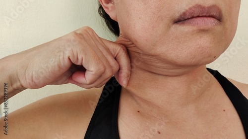 Portrait the fingers holding the flabbiness adipose sagging skin under the chin, neck wattle and cellulite, loose and scar, Flabby skin and creases under the neck, health care and beauty concept.