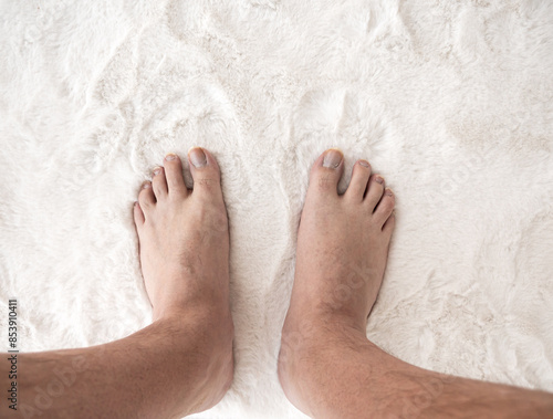 Male foot with long ugly nails