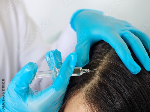 Hair Loss Treatment With A Syringe Injection In A Medical Setting