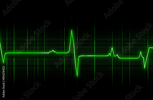 ekg heart beat