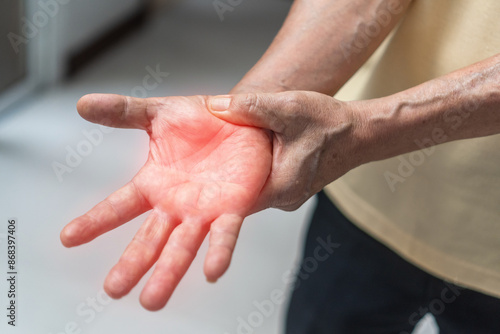 Peripheral Neuropathy pain, Guillain-Barre Syndrome GBS in elderly aged old patient on hand, fingers, sensory nerves with numb, muscle weakness, chronic inflammatory demyelinating polyneuropathy